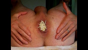 ⁣Anal Fist Toy Insertion Gape Ass Play -analdehner Ass Hole Extrem Gay Men