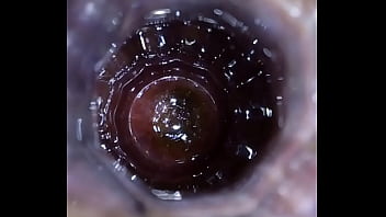 Anal, Hardcore, Ass, Inside, Gay, Bottle, Pain, Extreme, Soloboy, Vase – Gay – 2025 – Passionate – Show – Video 4869379