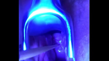 Swollen Ripe Cervix Really To Be Filled With Cum Is Stretched Out And Sounded