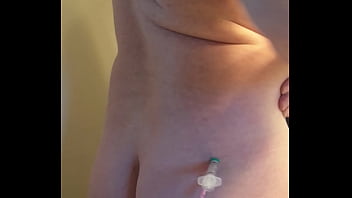 Buttocks, Injections – Unknown – 2025 – Passionate – Session – Video 4178553