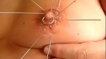 Self Tit Acupuncture