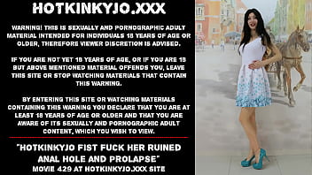 Hotkinkyjo Fist Fuck Her Ruined Anal Hole And Prolapse