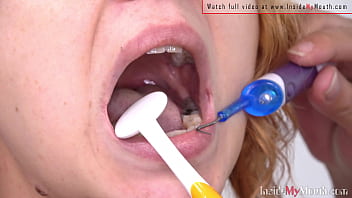 Mouth Fetish Video – Alex Get Dental And Mouth Examination From Sarah