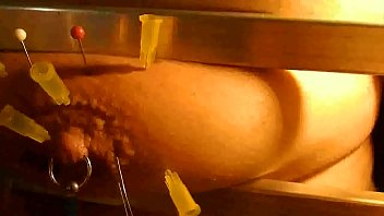 Breast Imobilisation Bars