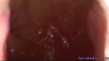 Speculum Babe Opens Up Her Gaping Ass For Us After Fingering