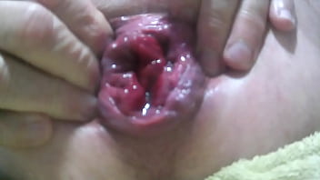 Anus, Audio, Prolapse, Rosebud, Ecarter – Unknown – 2025 – Intense – Experience – Video 1986296