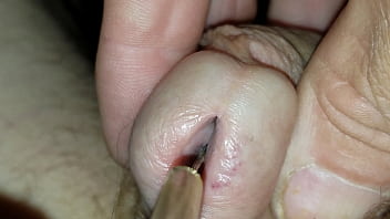 Me Inserting Estim Electrode Through Plastic Tubing Inside My Urethra To Sphincters Then Electrode Into My Bladder