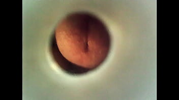 Zaglądam Endoskopem Do Cewki Moczowej