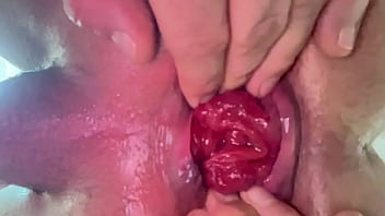 Little Prolapse Training 01.