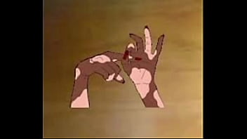 A Slideshow About Vitiligo