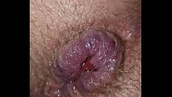 I Want Prolapse – Anal, Ass, Hole, Rosebud – Anal – 2025 – Hot – Performance – Video 1115451