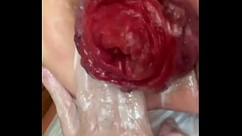 Ffistingsex – Fist, Gayfist, Gapehole – Fisting – 2025 – Incredible – Session – Video 879634