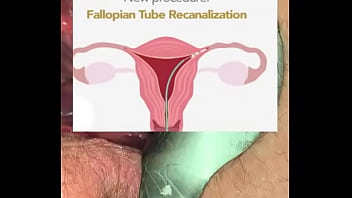 Deepest Gyno Play Ever