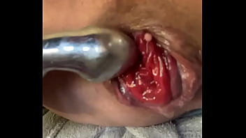 Aka Bianca , Fuck My Prolapse
