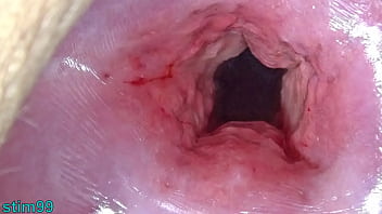Uncensored Japanese Cervix Stretching And Uterus Dilation With Penetration