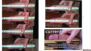 The Big Penis Enlargement Overview – 2024