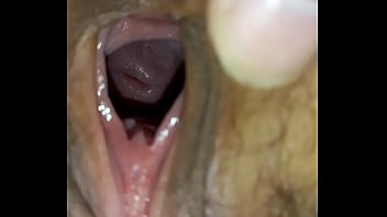 Vợ chổng m_ng cho chồng soi tử cung viẹt nam